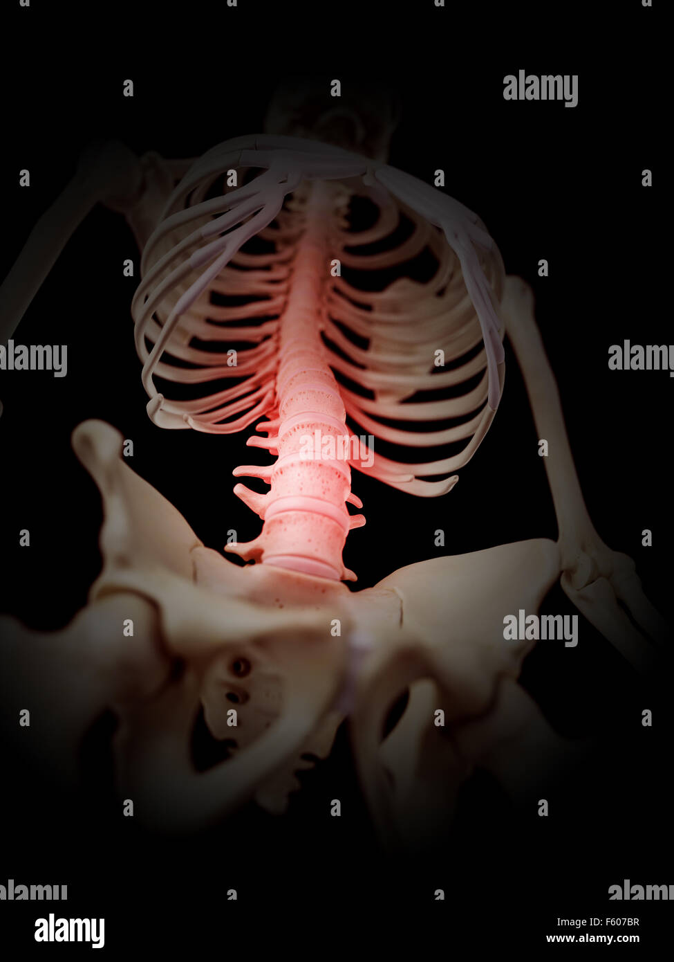 medically accurate illustration - painful spine Stock Photo - Alamy