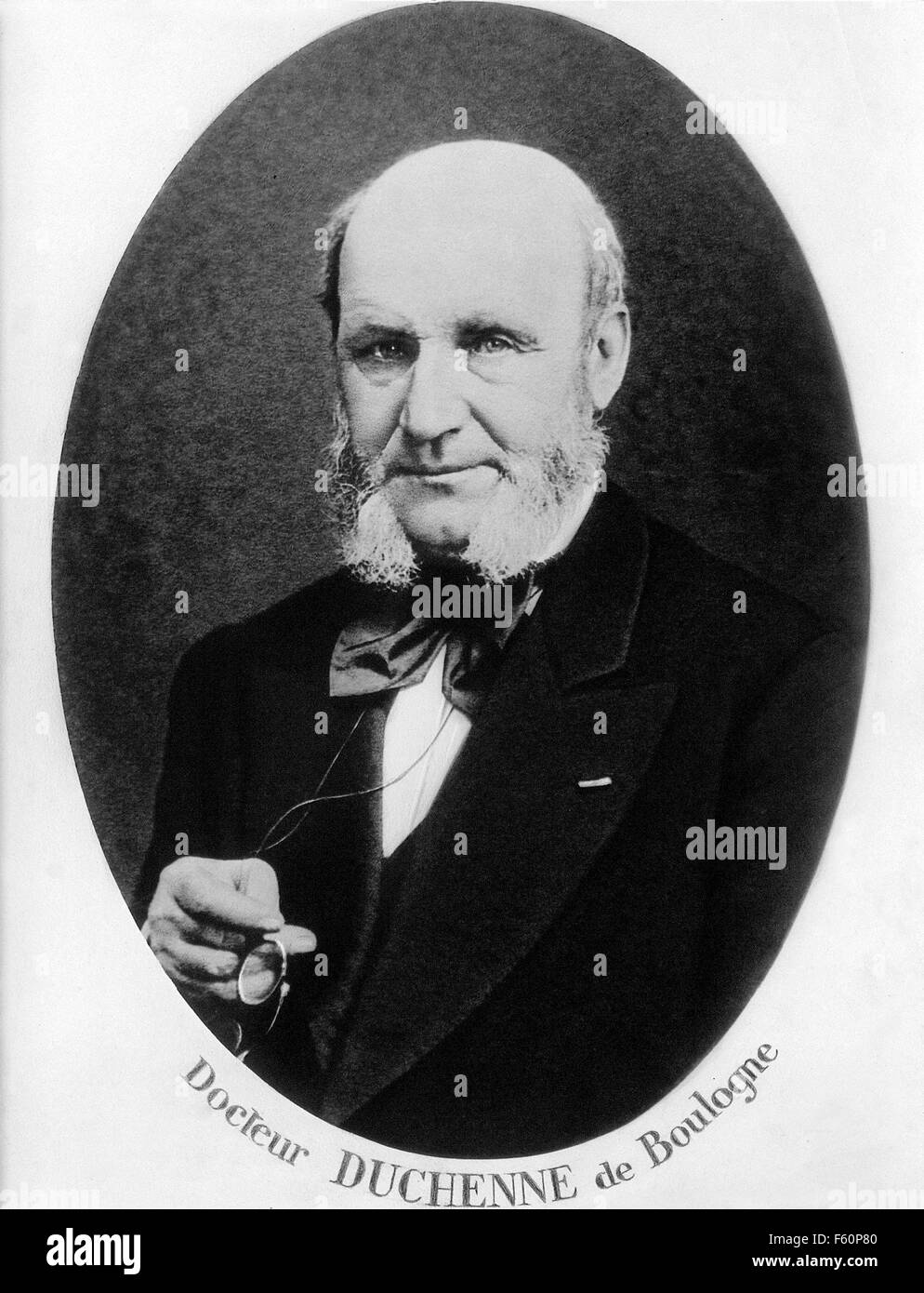 GUILLAUME DUCHENNE (1806-1875) French physician who worked on neurology, about 1860 Stock Photo