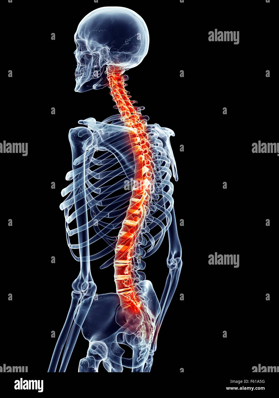 medically accurate illustration - painful lumbar spine Stock Photo - Alamy