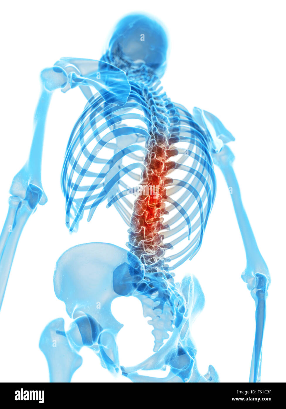 medically accurate illustration - painful lumbar spine Stock Photo - Alamy