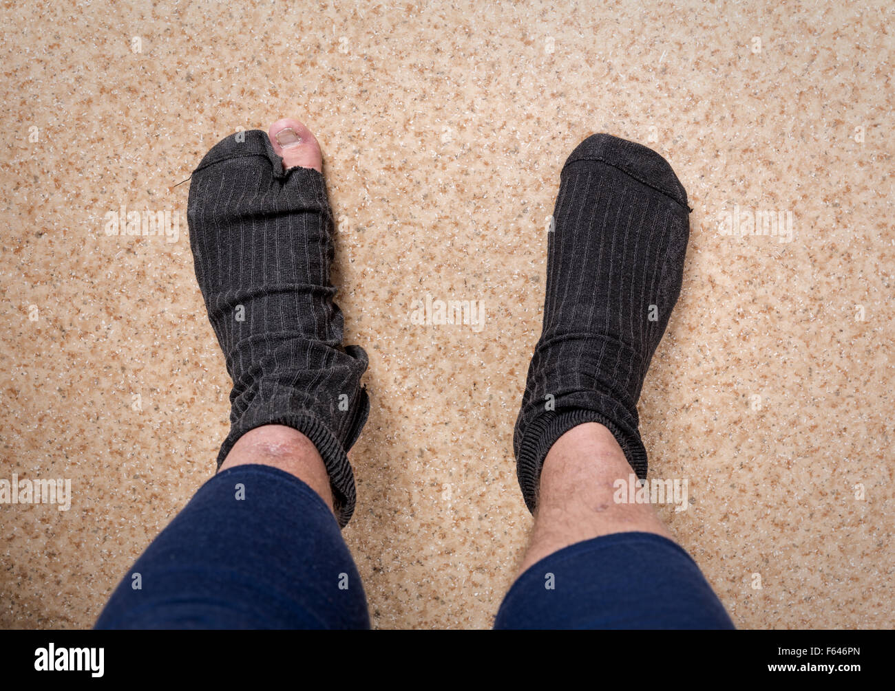 Male feet in old leaky socks Stock Photo