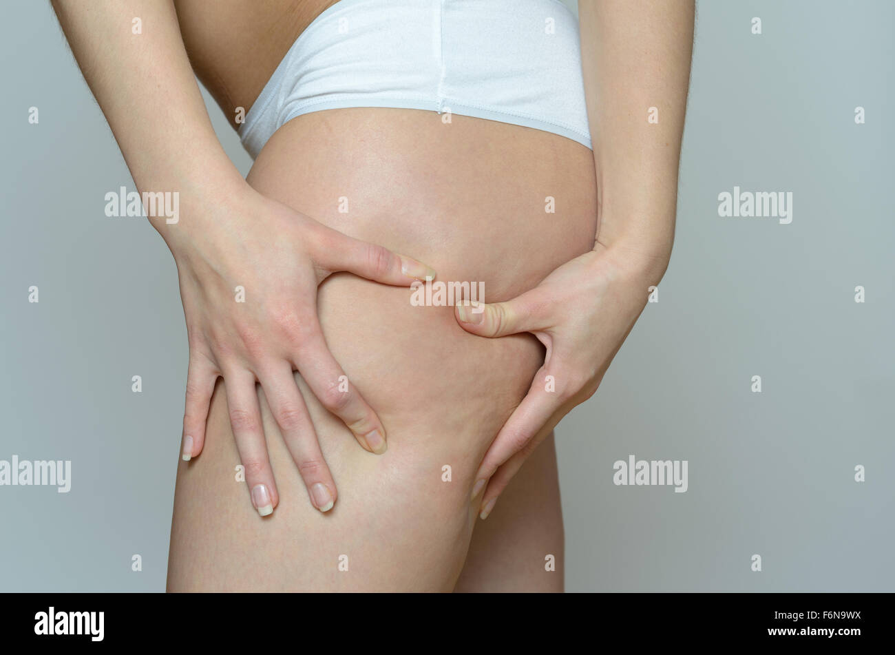 Close up Young Woman Pinches the Cellulite Area on her Thigh Using Two Hands Against Gray Background. Stock Photo
