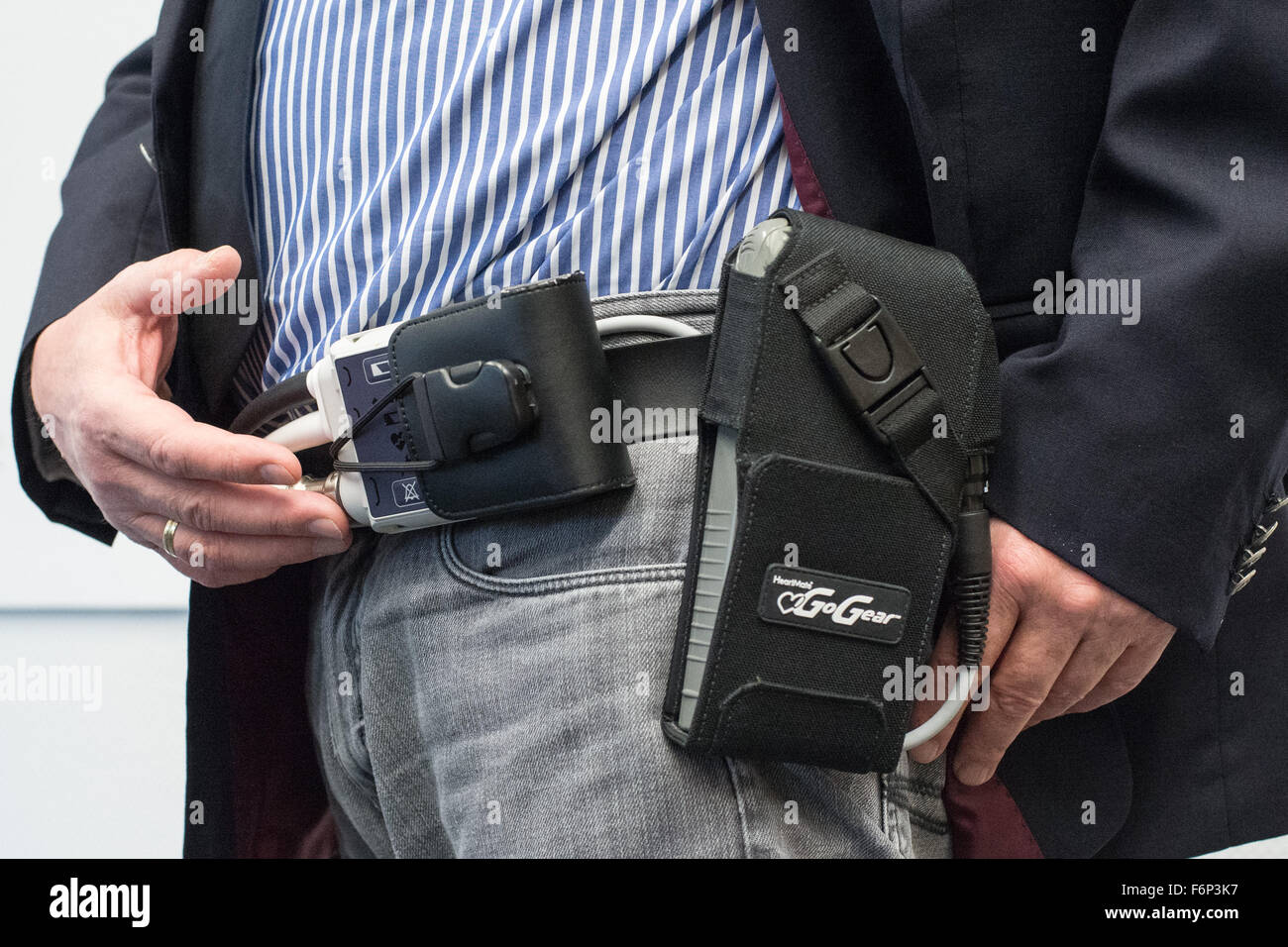 Heart Patient Uwe Schulze at a press conference in the Medical School (MHH) in Hannover (Lower Saxony), holding the ventricular assist device, 'HeartMate II' in his hand, while the battery (r) is monitored by a controller (l) Hannover, Germany, 18 November 2015. Schulz has lived for ten years with the artificial heart, he is a according to the MHH the European record holder. Photo: OLE SPATA/dpa Stock Photo