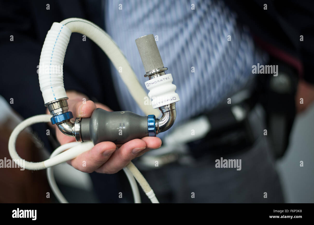 Heart Patient Uwe Schulze at a press conference in the Medical School (MHH) in Hannover (Lower Saxony), holding the ventricular assist device, 'HeartMate II' in his hand, Hannover, Germany, 18 November 2015. Schulz has lived for ten years with the artificial heart, he is a according to the MHH the European record holder. Photo: OLE SPATA/dpa Stock Photo