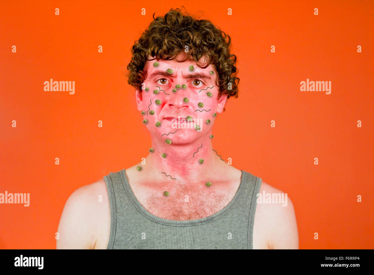 Unhappy feverish man covered in sweat and bacteria viruses Stock Photo