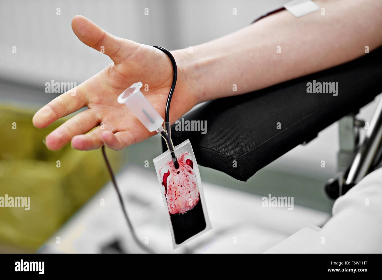 Detail with the hand of a blood donor and a plastic blood bag in a hospital Stock Photo