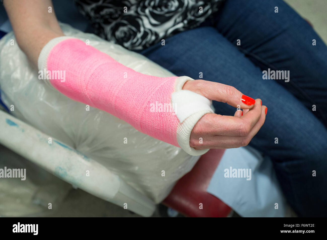 Freshly plastered lady's wrist in a pink plaster cast in a hospital accident and emergency department. Stock Photo