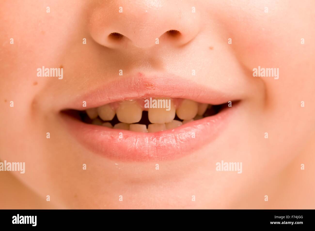 Child smiling white teeth hi-res stock photography and images - Alamy