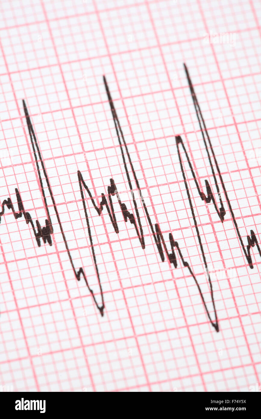 Printout from cardiograph Stock Photo