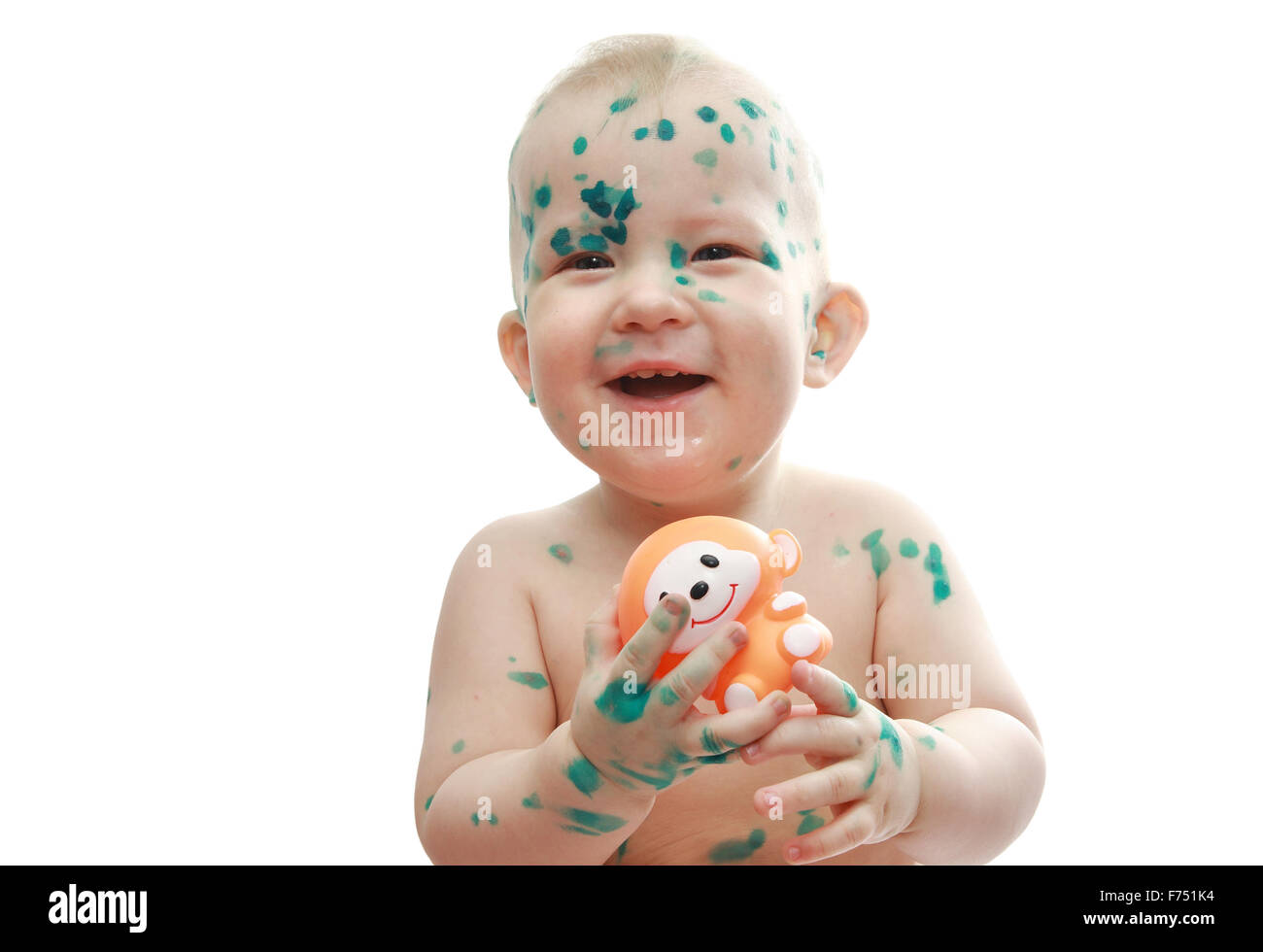 Chicken pox virus hi-res stock photography and images - Alamy