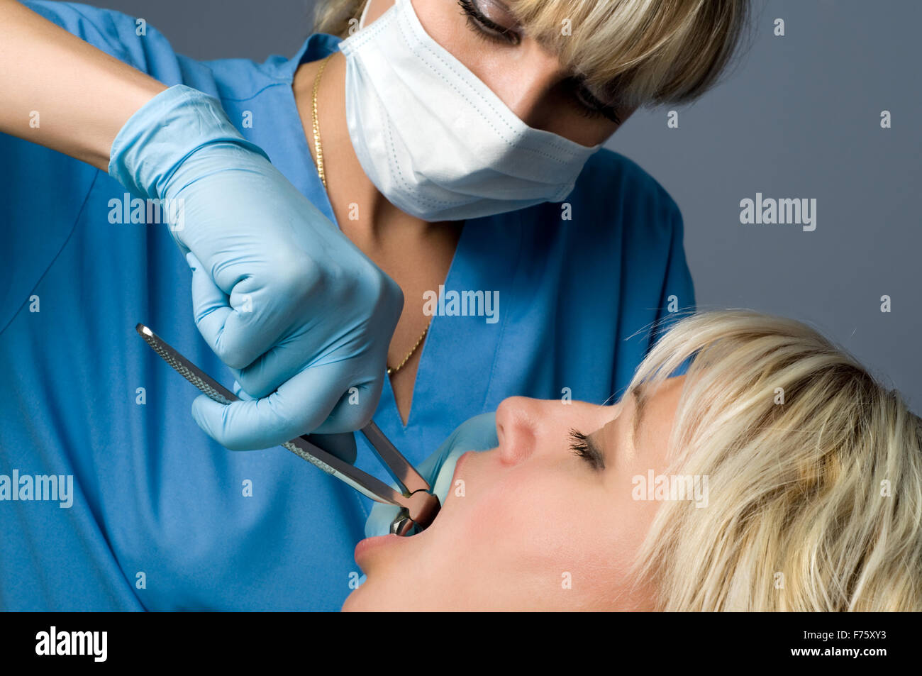 tooth extraction Stock Photo
