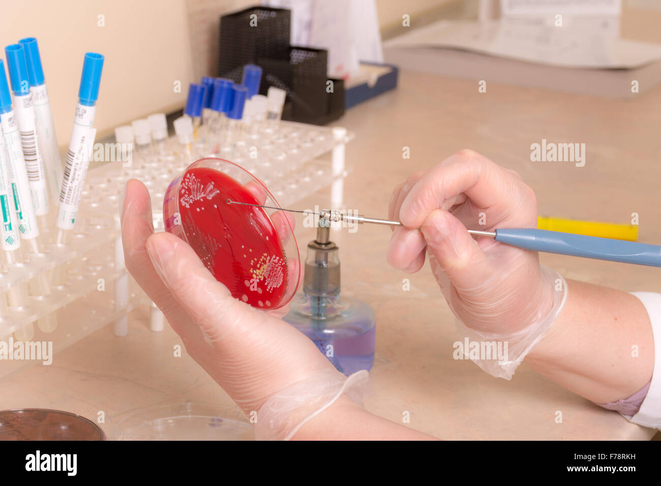 Testing of blood samples for diseases and hormones Stock Photo Alamy
