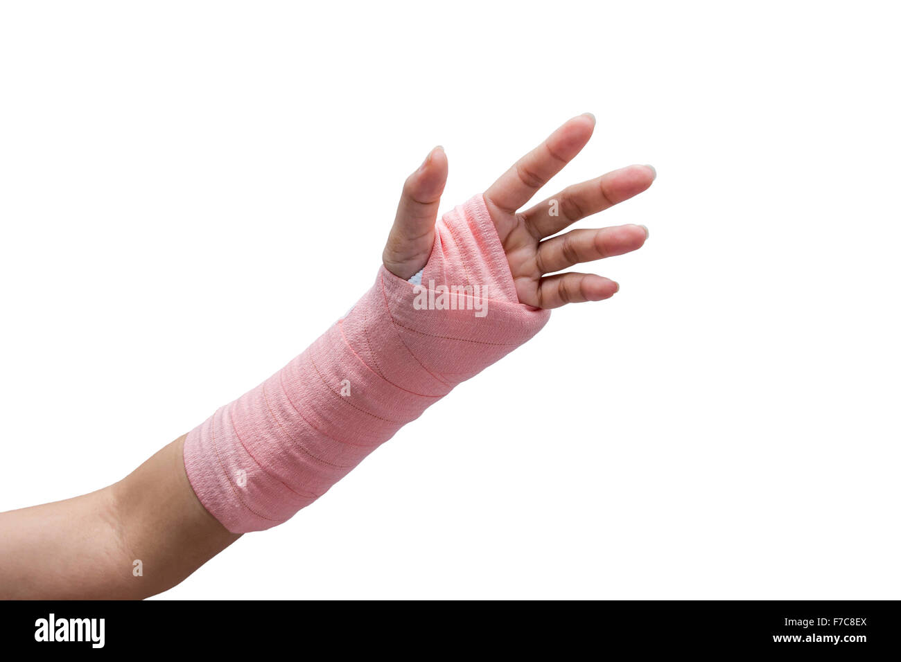 Splint,broken bone,broken hand isolate on white background Stock Photo