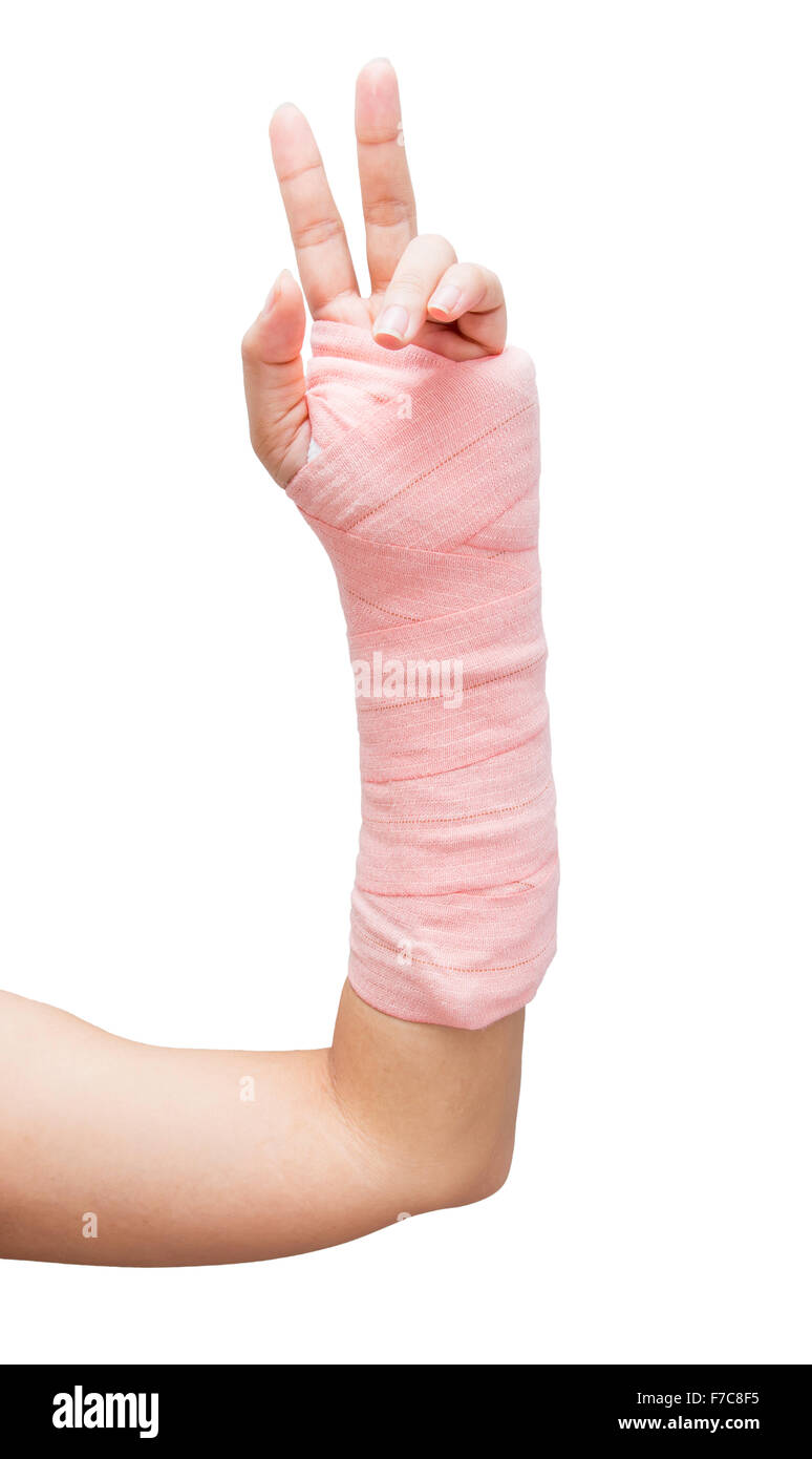 Splint,broken bone,broken hand isolate on white background Stock Photo