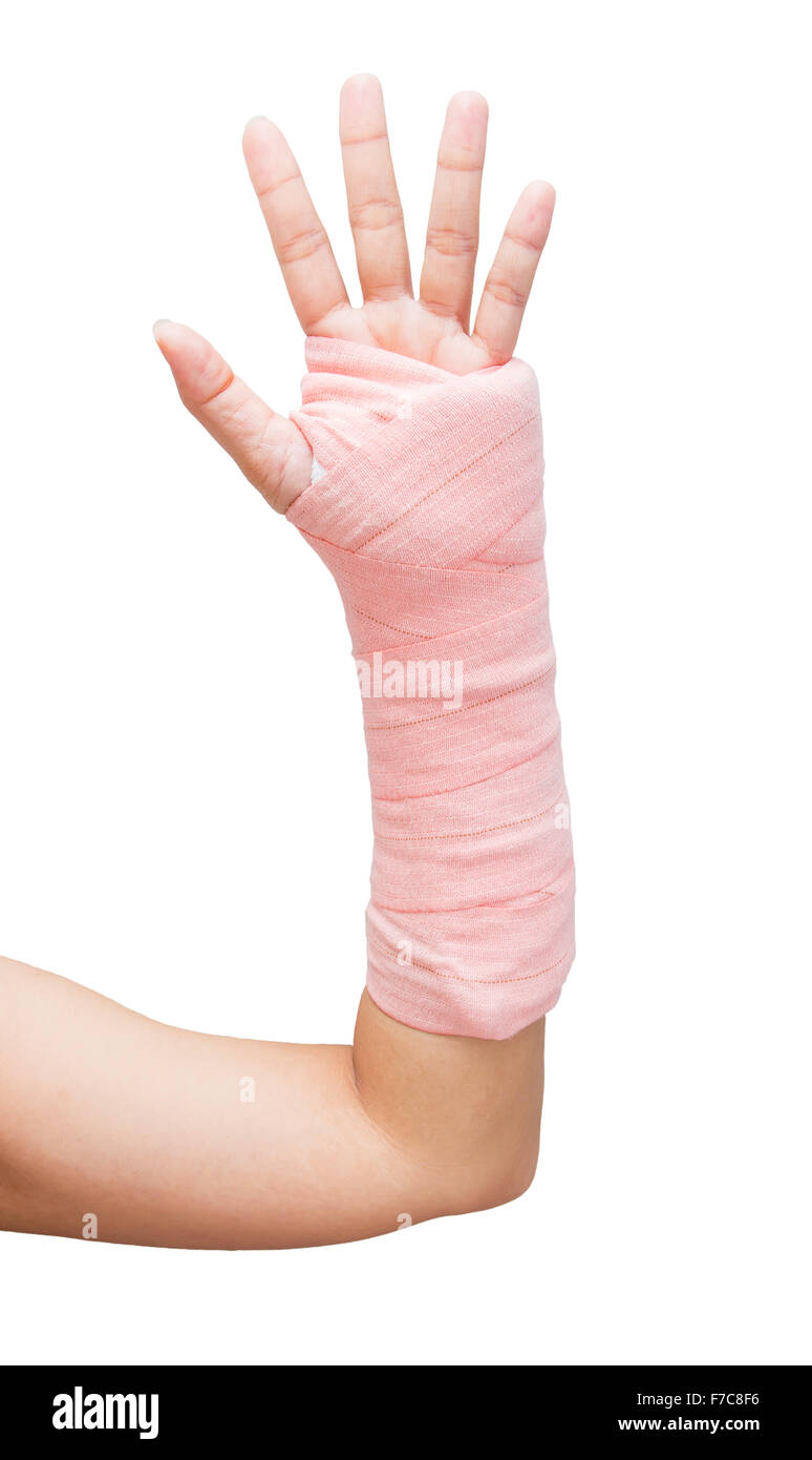 Splint,broken bone,broken hand isolate on white background Stock Photo