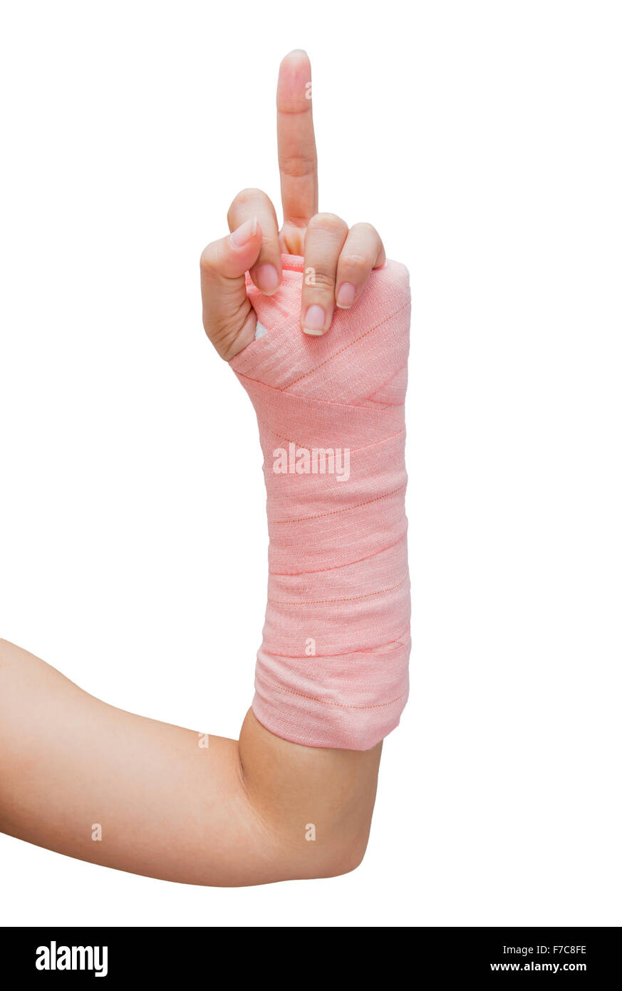 Splint,broken bone,broken hand isolate on white background Stock Photo