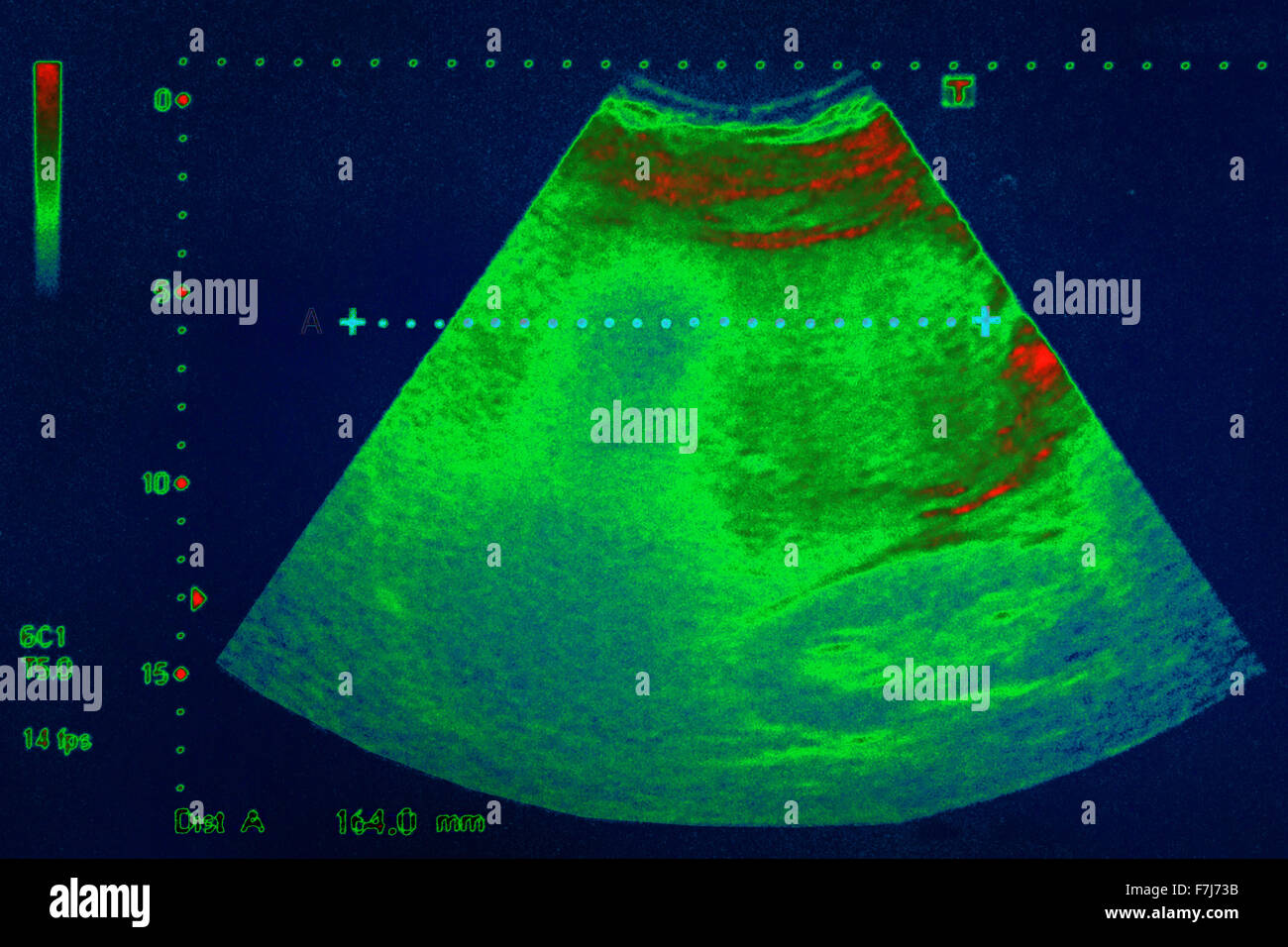 Ultrasound hires stock photography and images Alamy