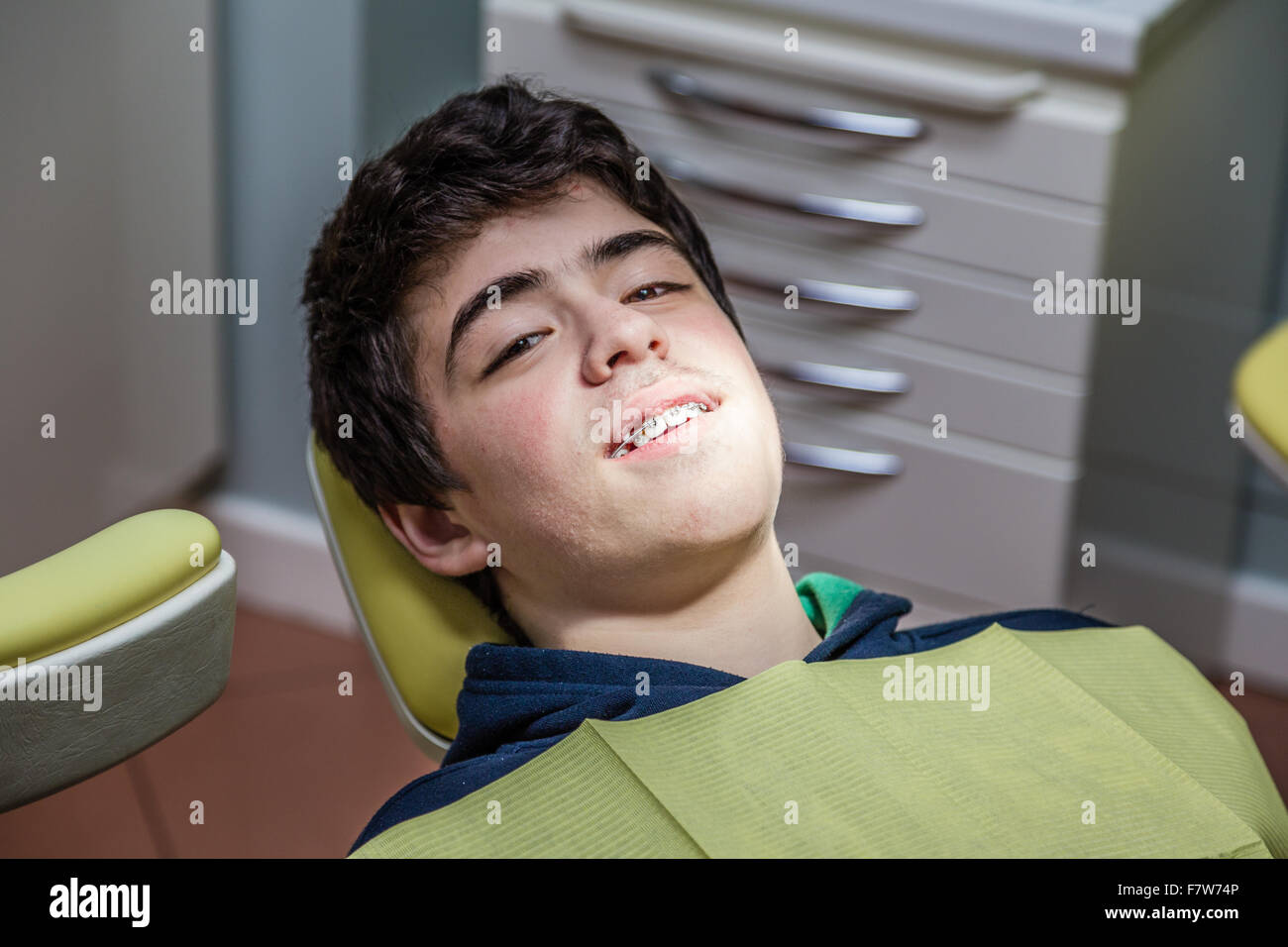 Caucasian teenager with acne skin lying on the dentist chair is smiling showing braces Stock Photo