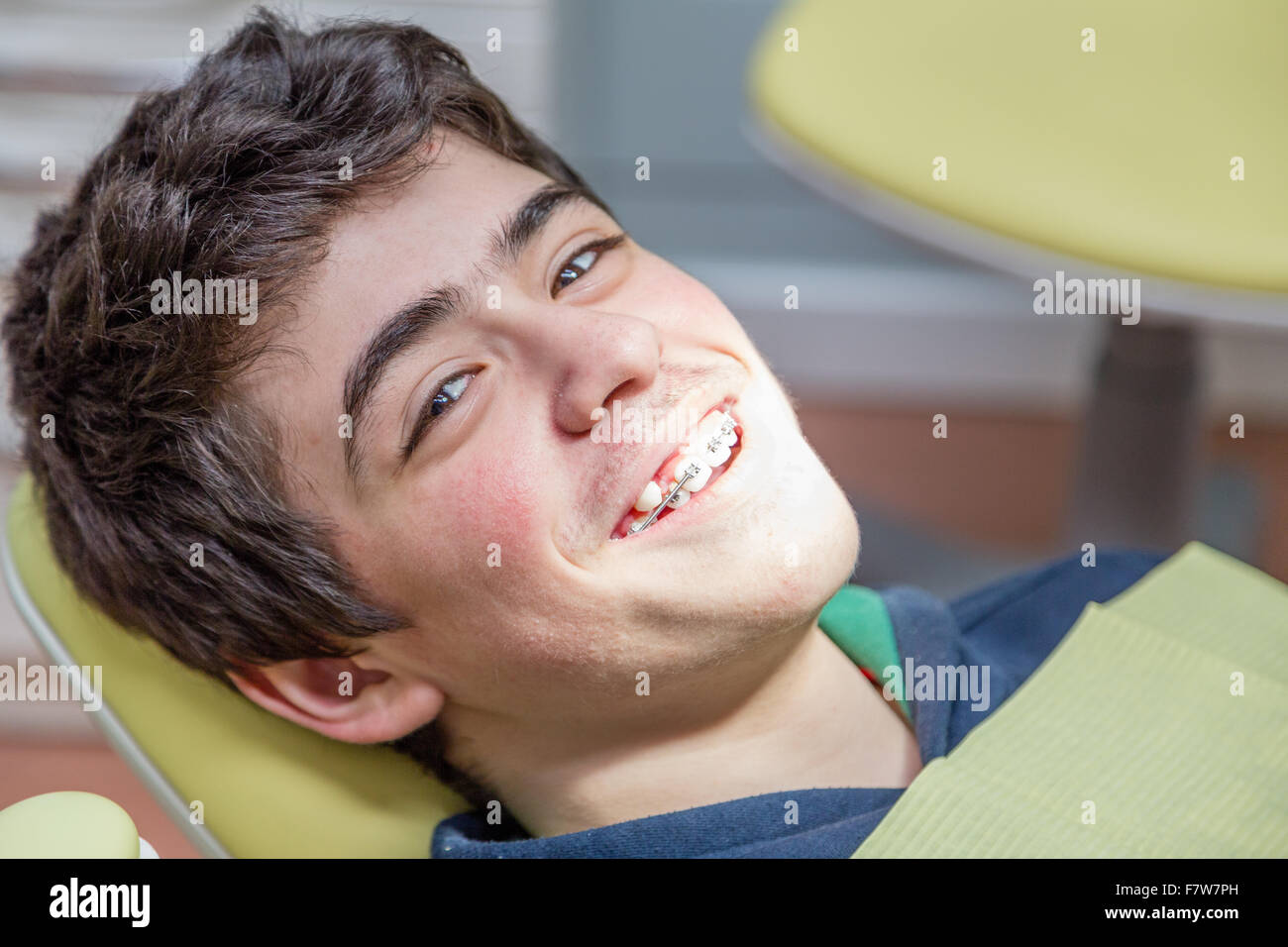 Caucasian teenager with acne skin lying on the dentist chair is smiling showing braces Stock Photo