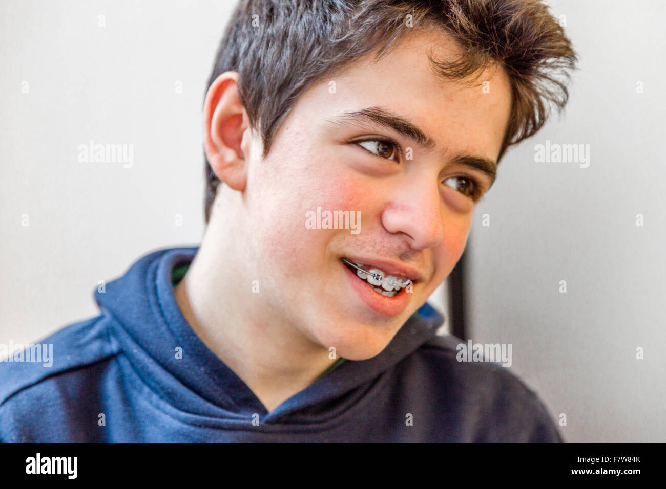 caucasian boy happy and smiling with braces on teeth, boy looking to his left Stock Photo