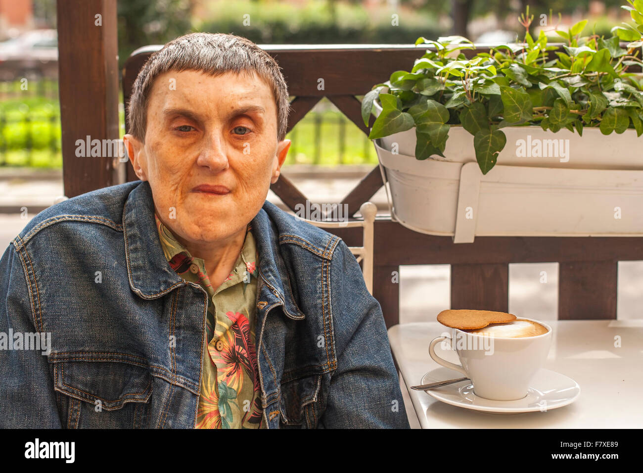 Disabled man with cerebral palsy closeup portrait in outdoor cafe. Stock Photo