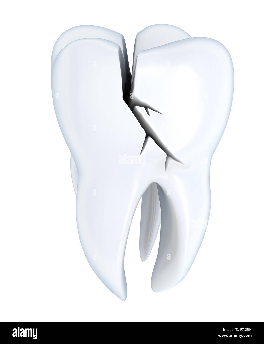 Broken tooth human Tooth (done in 3d, isolated Stock Photo - Alamy