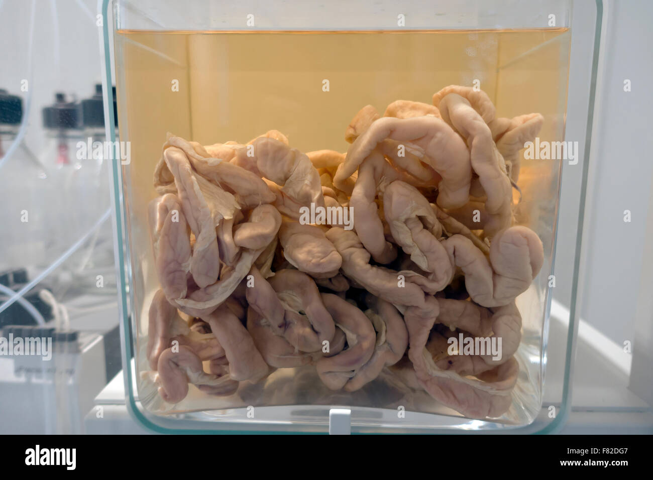 Original human intestines and intestinal system specimen preserved in formalin jar. Medical Museion, Copenhagen, Denmark. Stock Photo