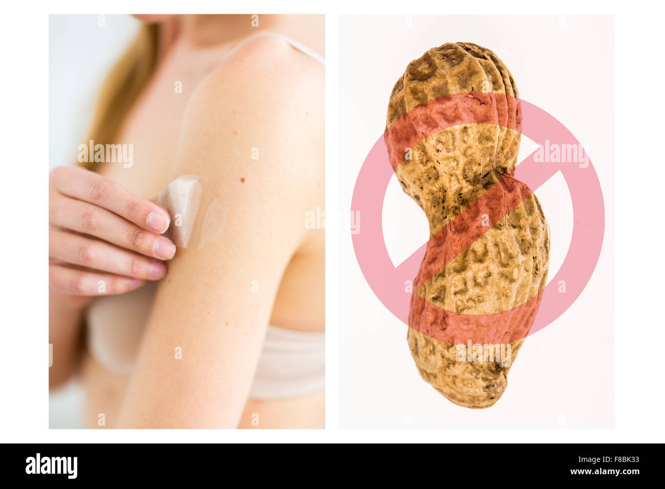 Composite on treatment against allergies to peanuts per patch. Stock Photo