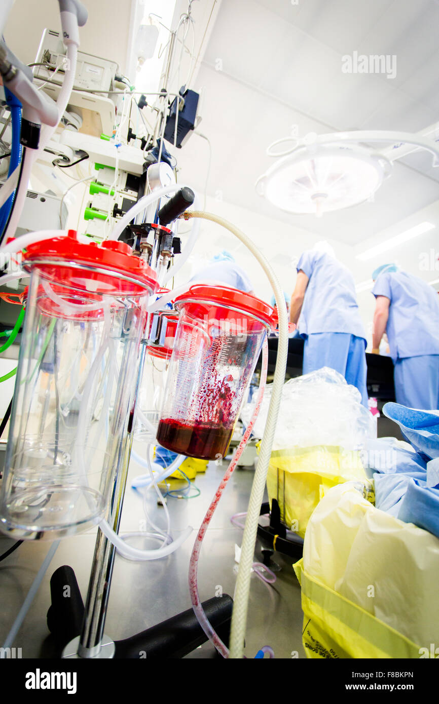 Outer canister for intraoperative blood recovery Stock Photo Alamy