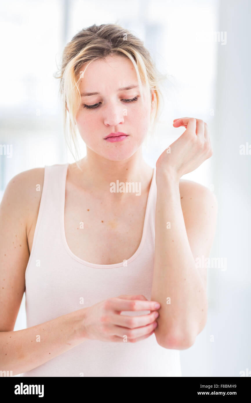 Woman itching her arm. Stock Photo