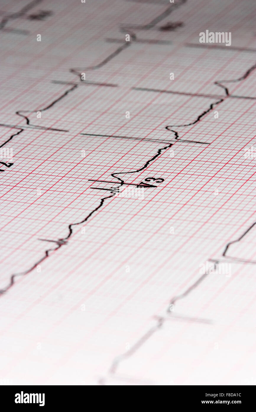 ecg hi-res stock photography and images - Alamy