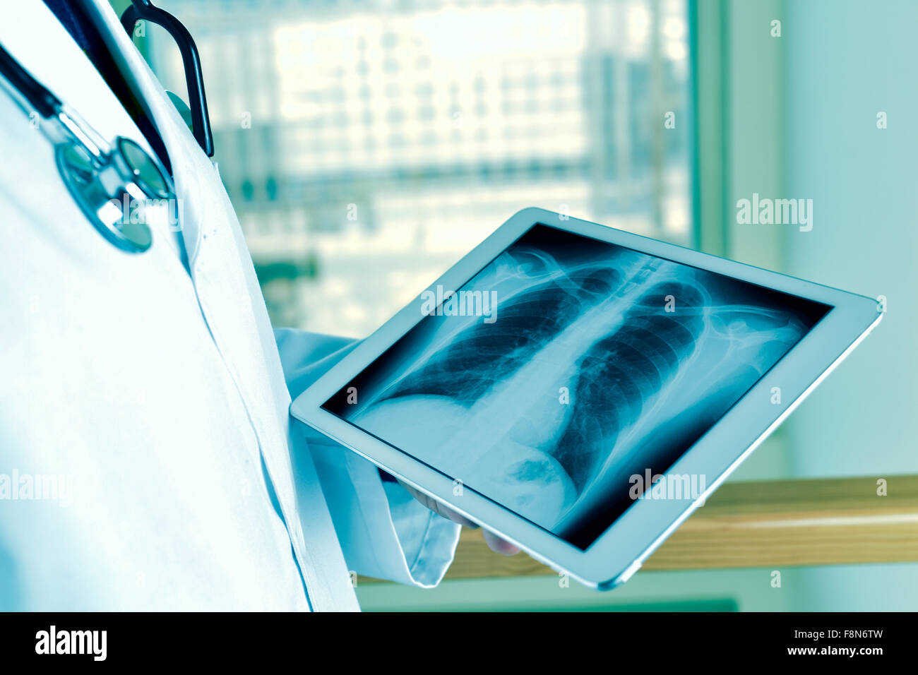 closeup of a young caucasian doctor man observing a chest radiograph in a tablet computer Stock Photo