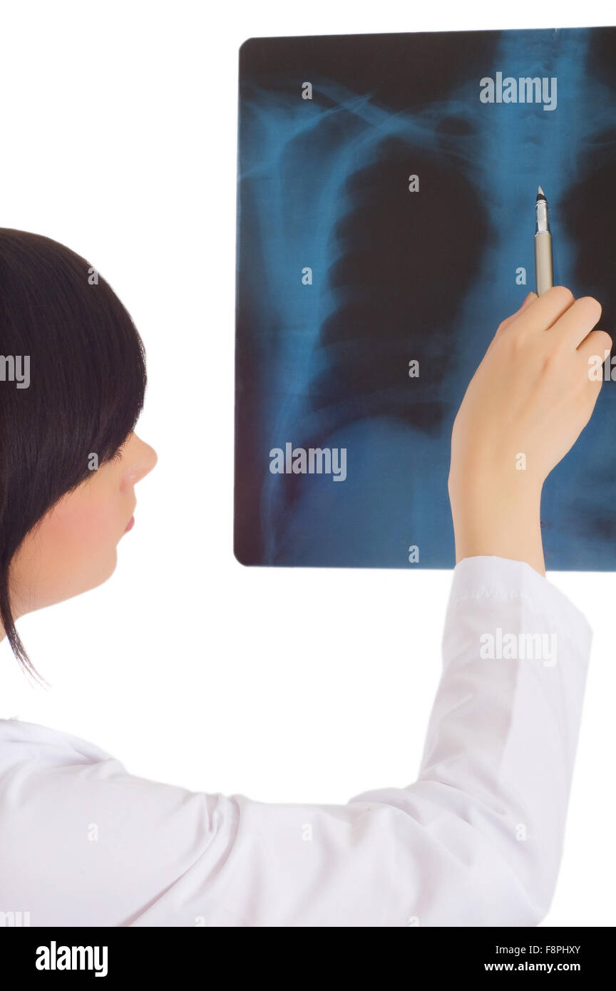 Female doctor looking at x-ray image on white Stock Photo - Alamy