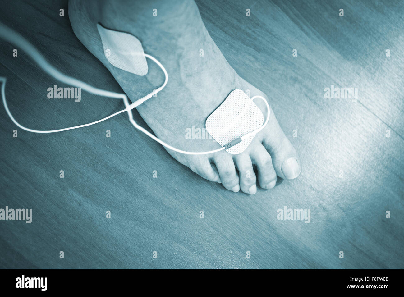 Patient foot, leg and ankle in electro physiotherapy electrical impulse