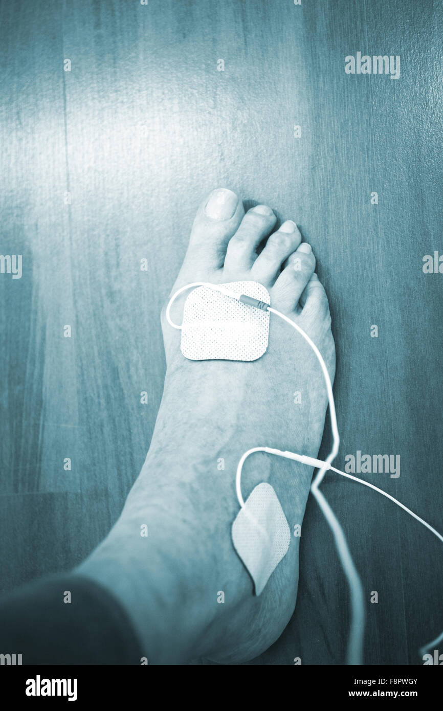 Patient foot, leg and ankle in electro physiotherapy electrical impulse