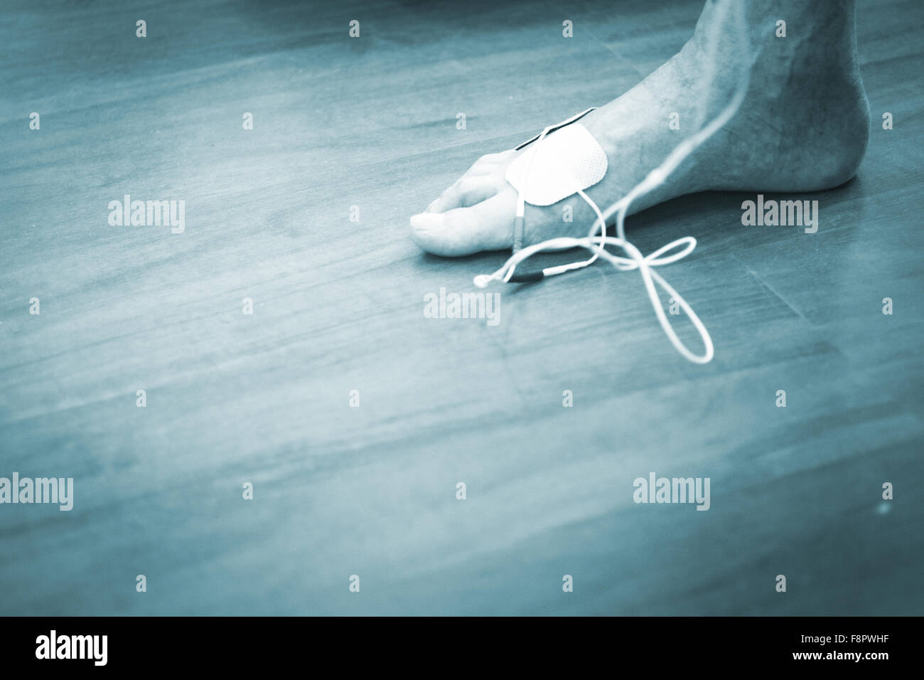 Patient foot, leg and ankle in electro physiotherapy electrical impulse