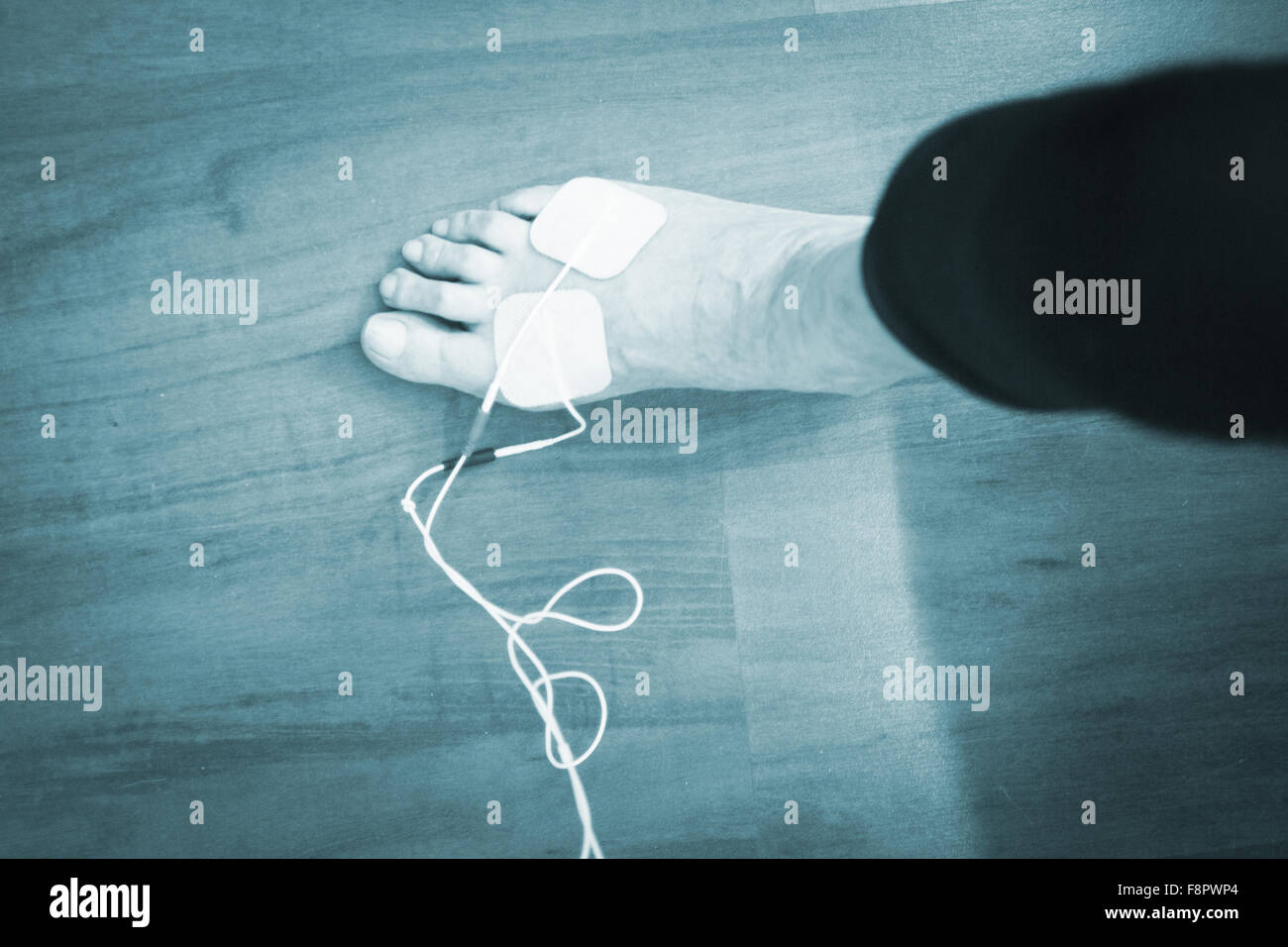 Patient foot, leg and ankle in electro physiotherapy electrical impulse