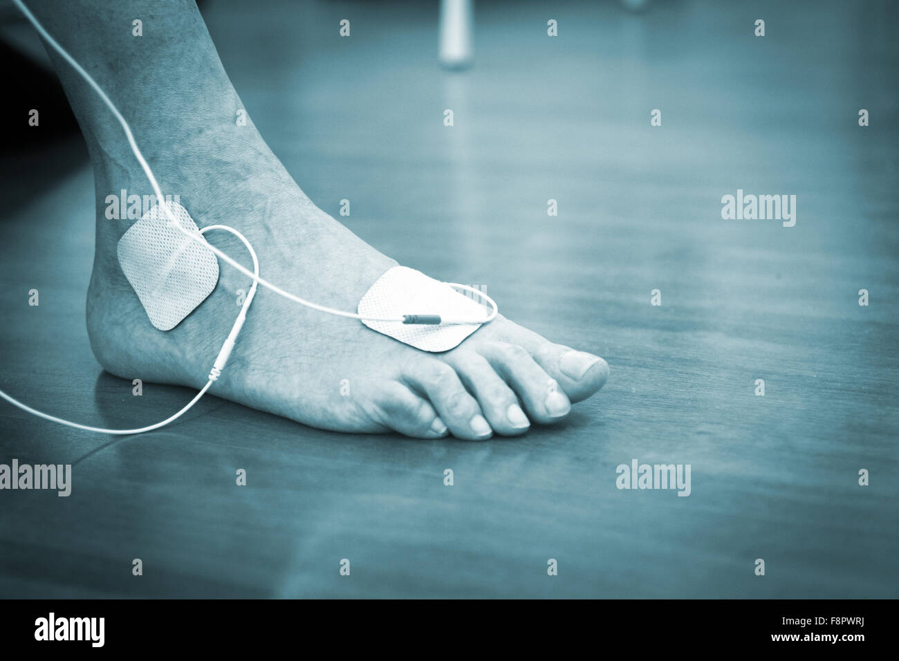 Patient foot, leg and ankle in electro physiotherapy electrical impulse