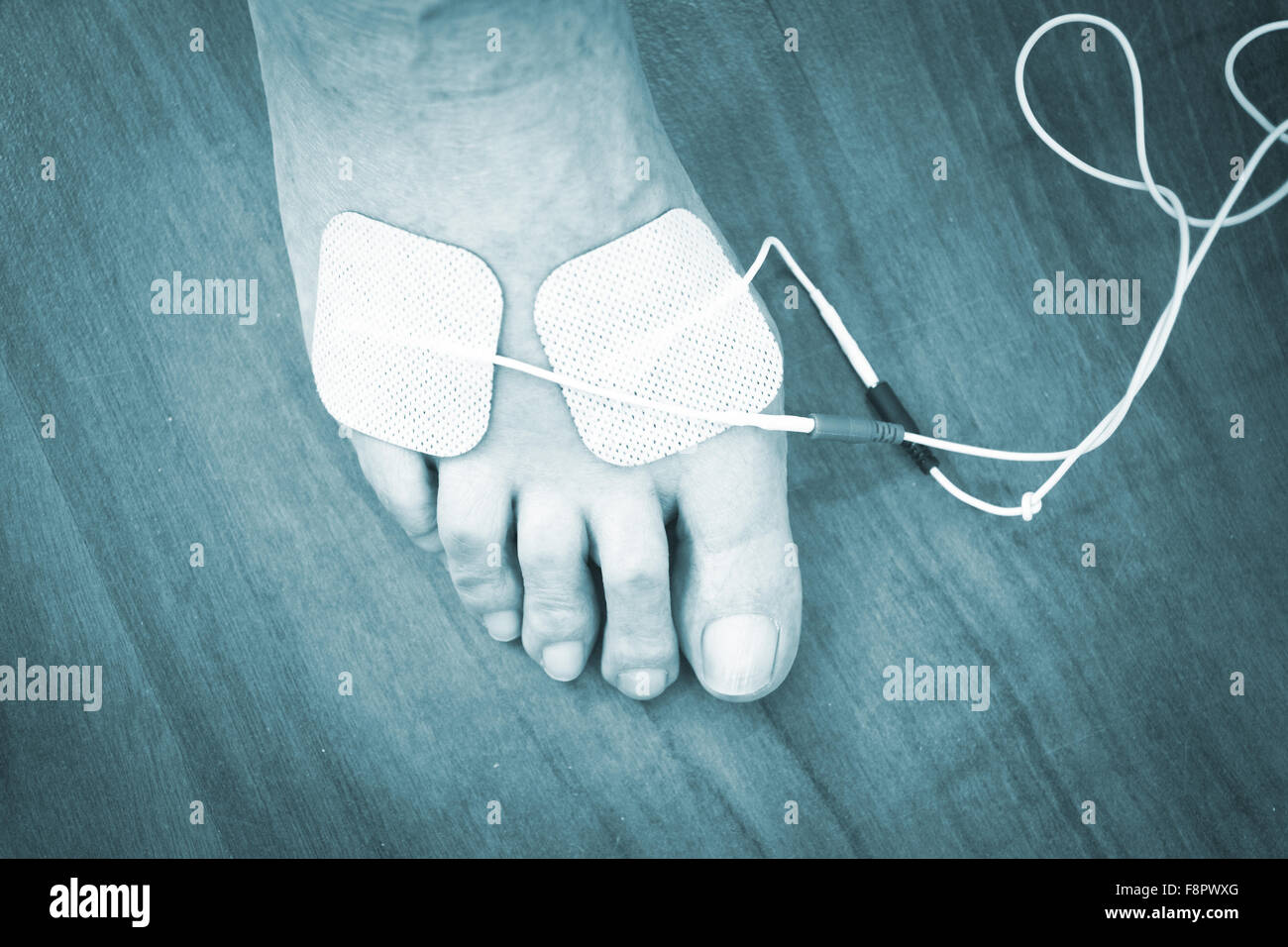 Patient foot, leg and ankle in electro physiotherapy electrical impulse