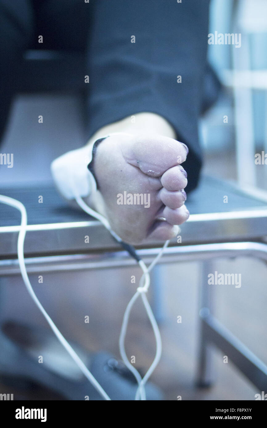 Patient foot, leg and ankle in electro physiotherapy electrical impulse