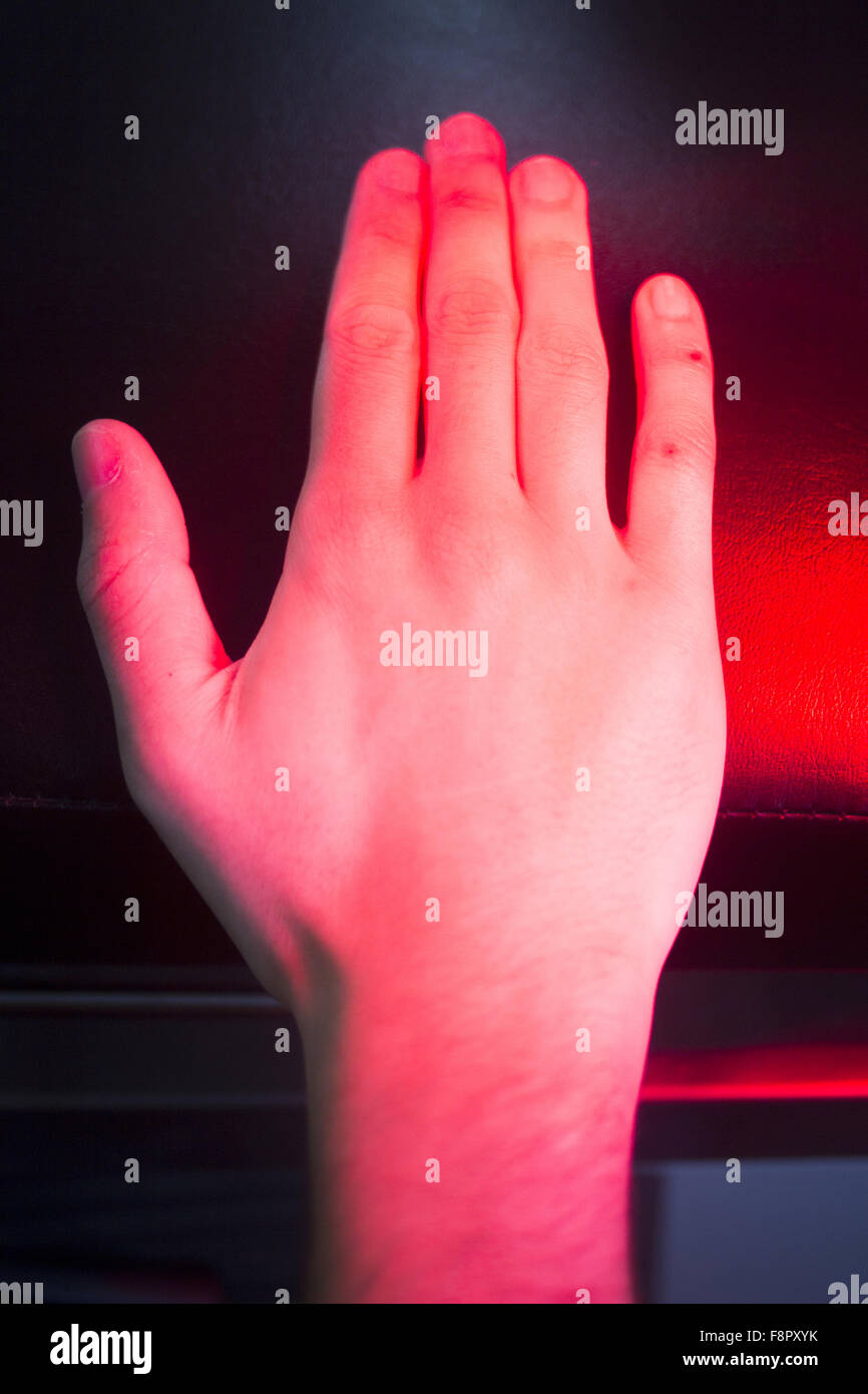Patient hand in red physiotherapy heat treatment under hot light Stock ...