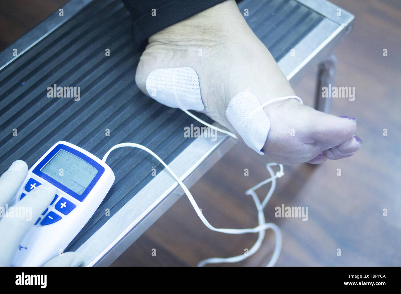Patient foot, leg and ankle in electro physiotherapy electrical impulse