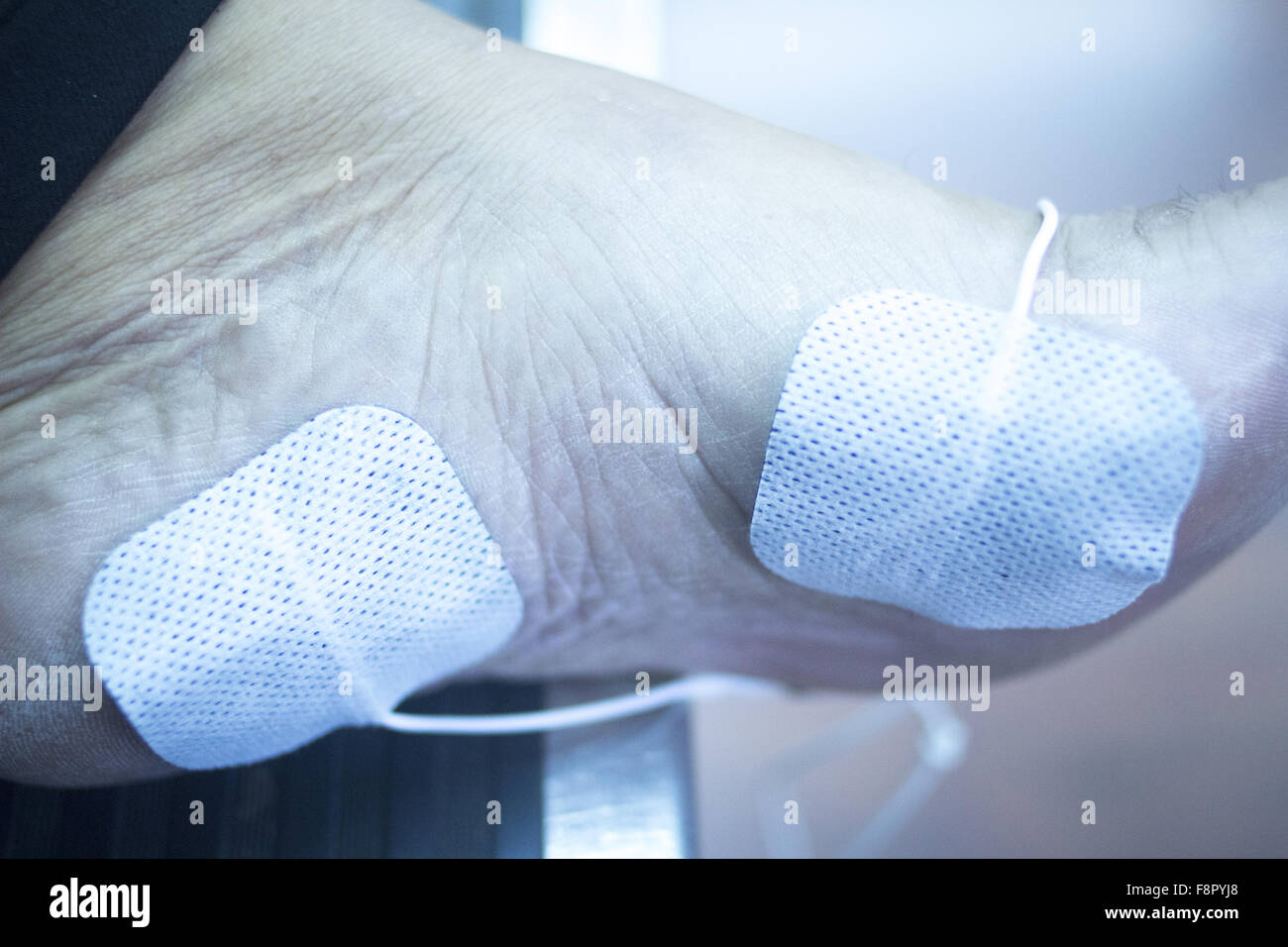 Patient foot, leg and ankle in electro physiotherapy electrical impulse