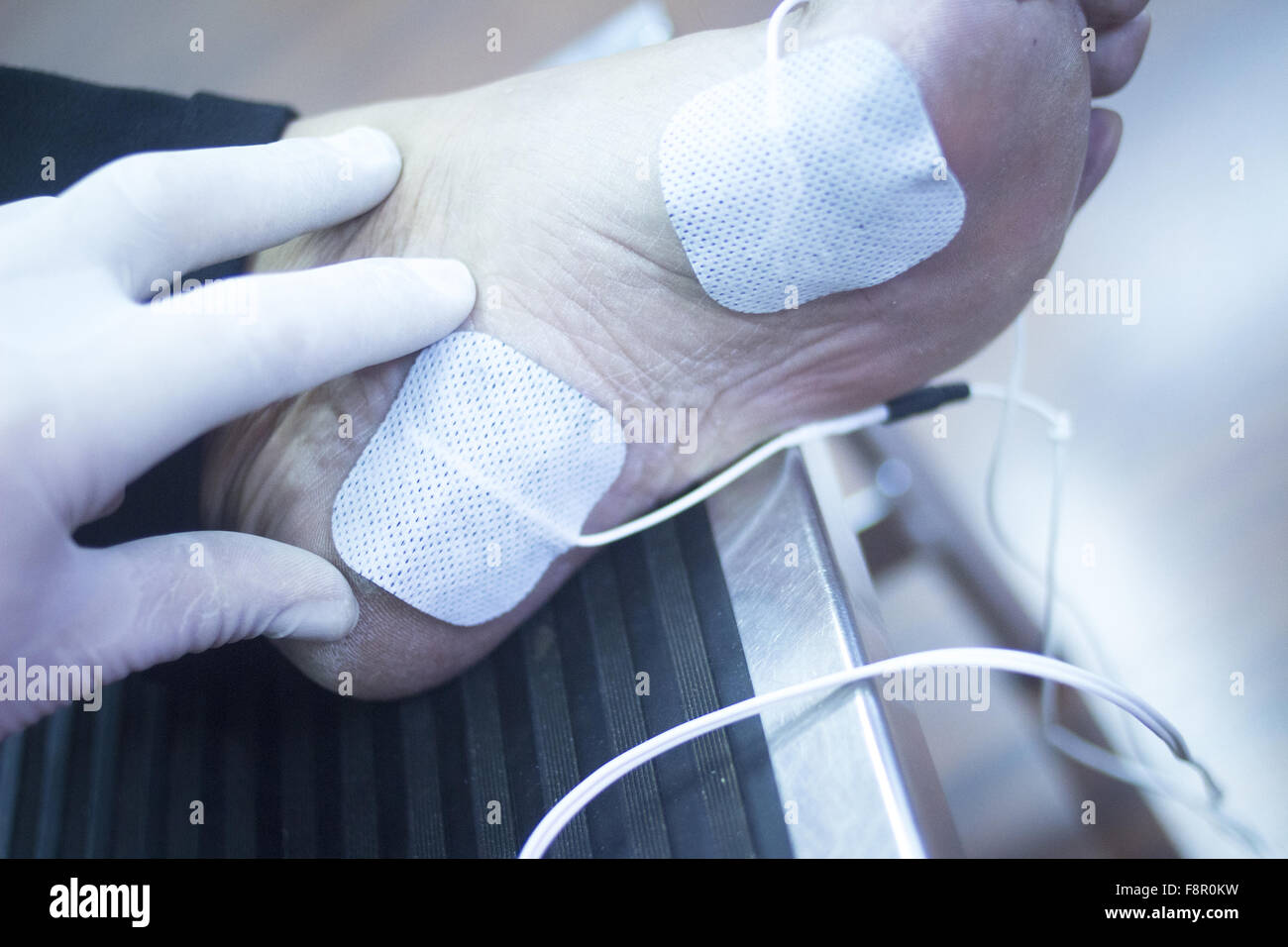 Patient foot, leg and ankle in electro physiotherapy electrical impulse