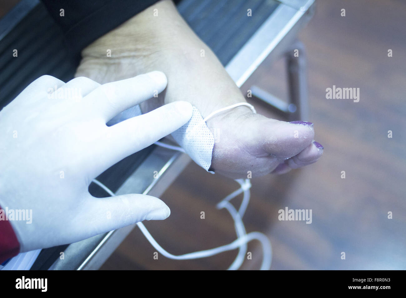 Patient foot, leg and ankle in electro physiotherapy electrical impulse