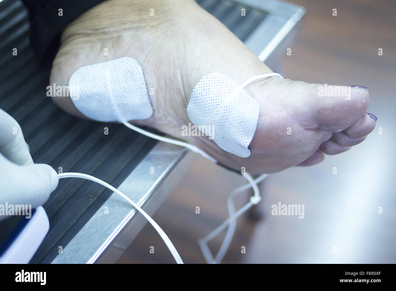 Patient foot, leg and ankle in electro physiotherapy electrical impulse