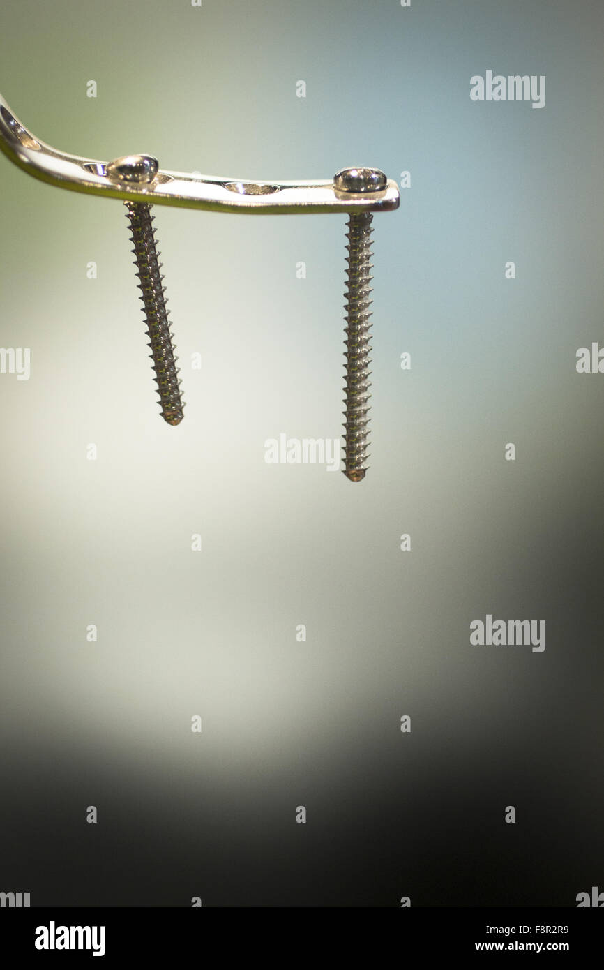 Traumatology and orthopedic surgery implant titanium plate and screws in semi silhouette against