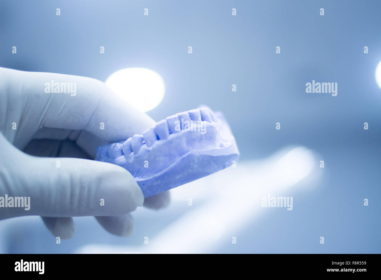 Dental mold dentist clay teeth plate ceramic colored cast model showing  tooth decay and gums of patient in dental clinic surgery for diagnosis and  treatment held in sterile glove hand of dentist