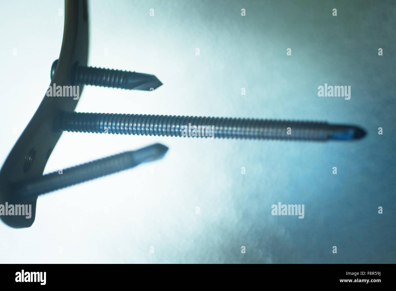 Traumatology and orthopedic surgery implant titanium plate and screws in semi silhouette against