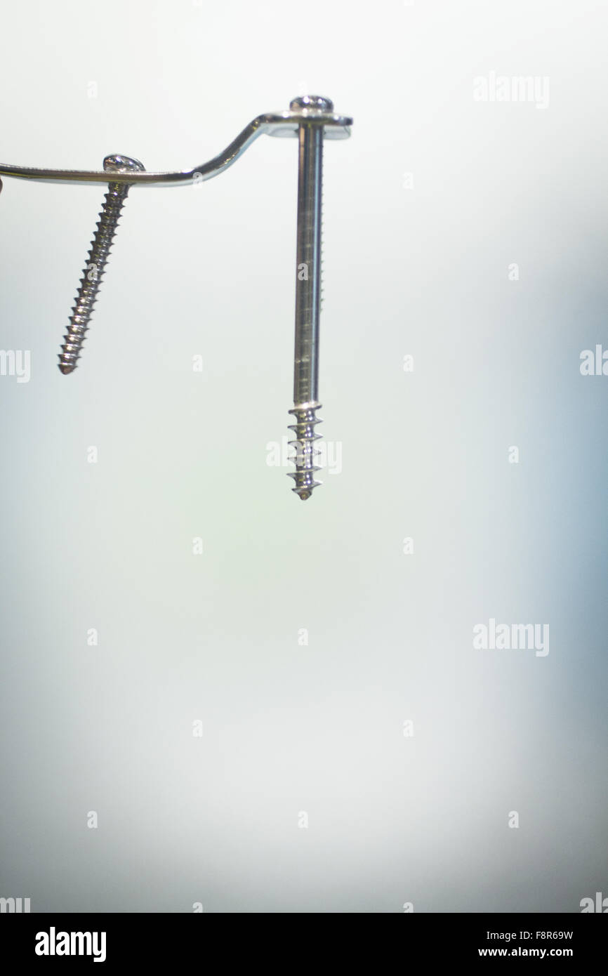 Traumatology and orthopedic surgery implant titanium plate and screws